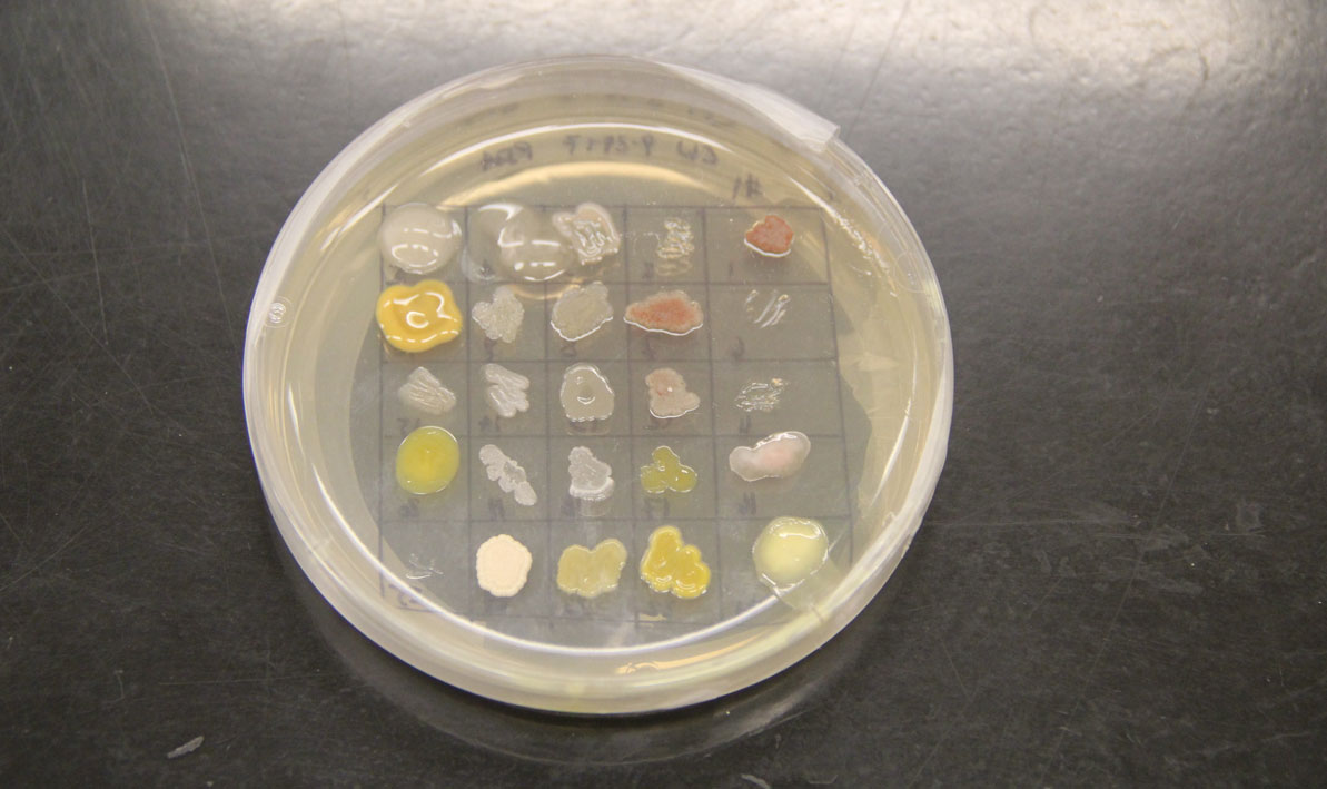 A petri dish with different strains of isolated bacteria